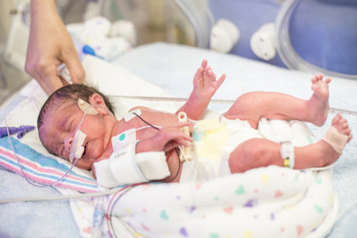 Hal Penting Yang Harus Diketahui Dalam Merawat Bayi Yang Prematur